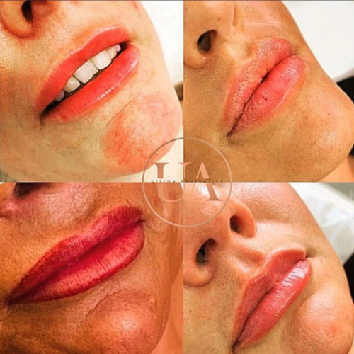 Natural and volume juicy lips filler