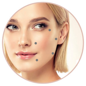 Skin Boosters Areas
