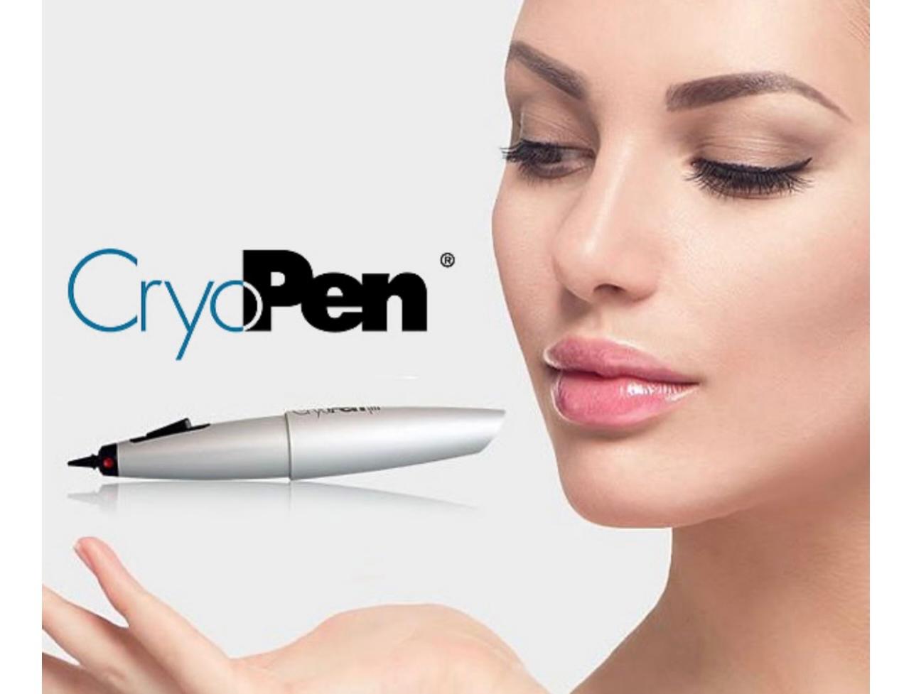 Cryotherapy Pen Gadget For Skin